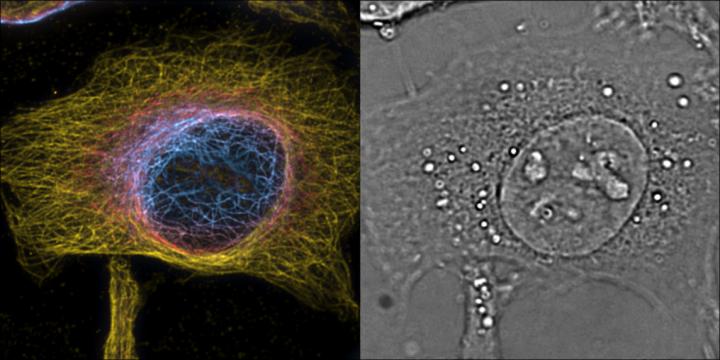 HeLa Cells Imaged with the New Technique