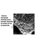 Electron Micrograph