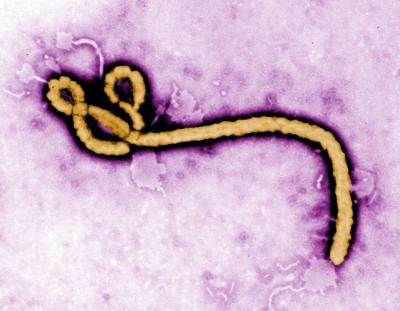 Electron Micrograph of Ebola Virus