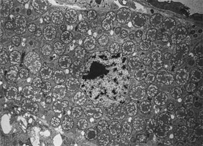 Symbionts (Buchnera aphidicola) Within a Bacteriocyte of a Pea Aphid (Acyrthosiphon pisum)