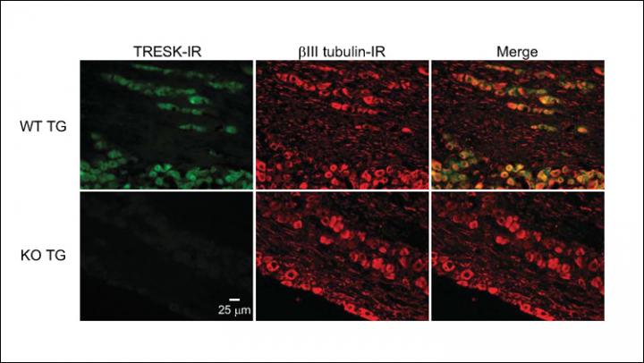 Defective Potassium Channels Cause Headache, Not Body Pain