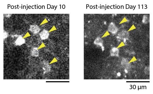 Two-Photon Calcium Imaging of the Same Neurons Over 100 Days