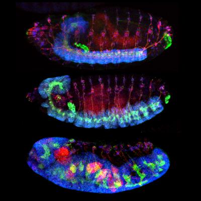 Effect of TM2D3 Mutaton in the Fruit Fly