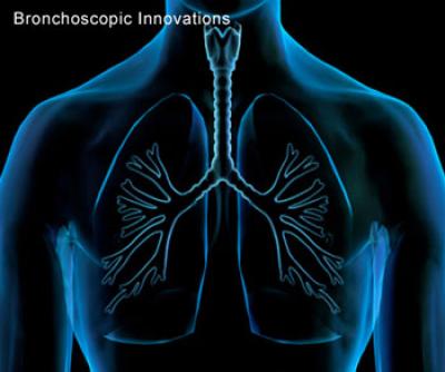 LungPoint -- Bronchoscopic Navigation System