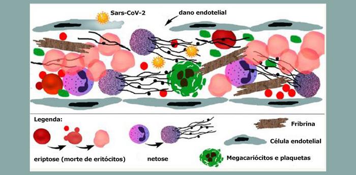 New study proves that severe COVID-19 is a thrombotic disease