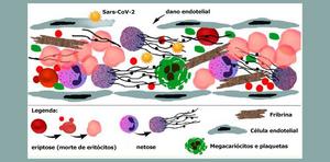 New study proves that severe COVID-19 is a thrombotic disease