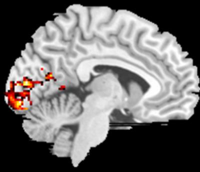 MRI of Preferred Retinal Location