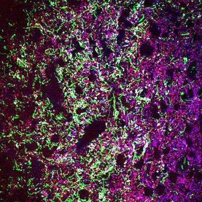 Basal Ganglia Neurons