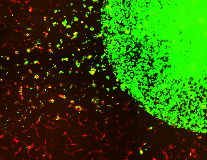 Encapsulated stem cells