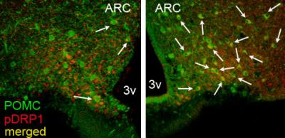 Size Matters when It Comes to Keeping Blood Sugar Levels in Check