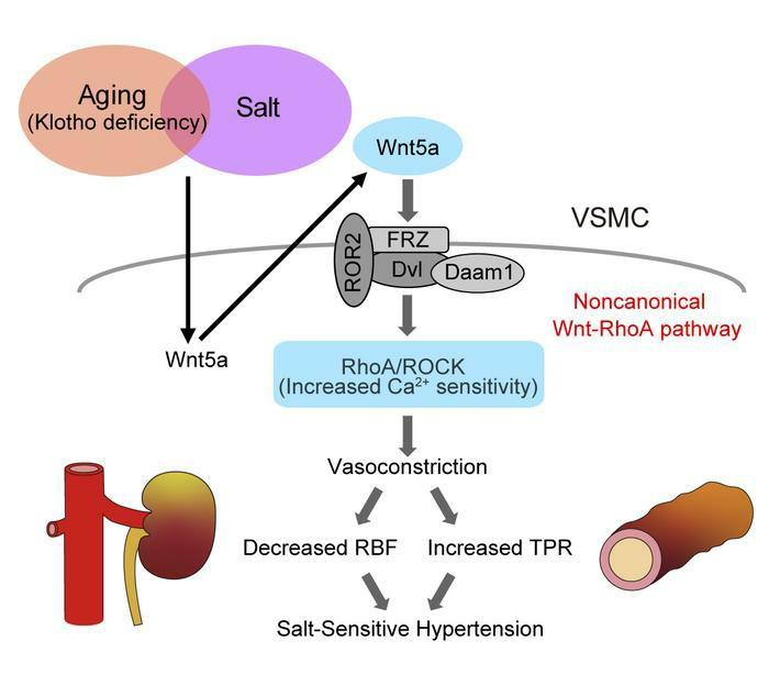 Salt and shop high blood pressure