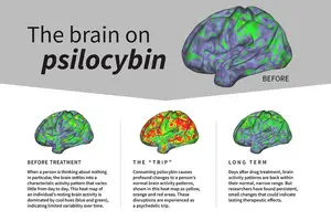 Psilocybin-2 (infographic)