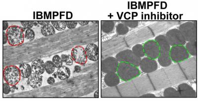 VCP Inhibitors Revert Pathology Seen in IBMPFD Diseased Fruitflies