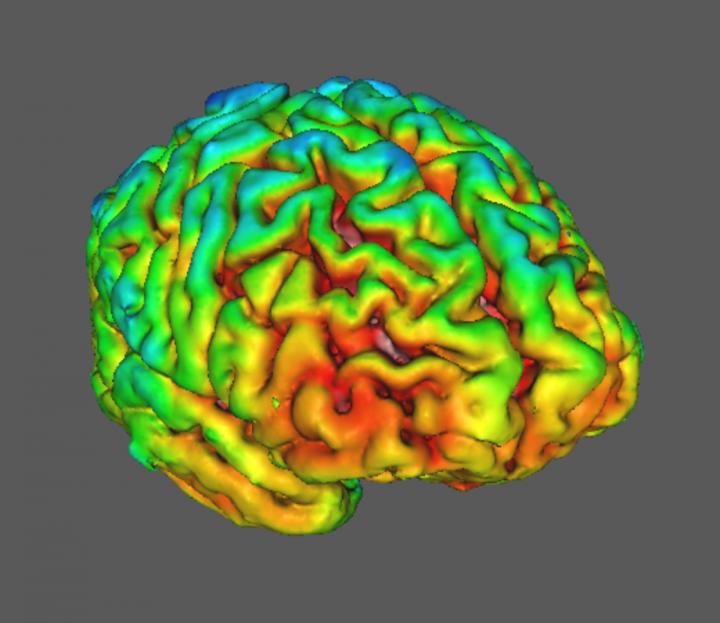 Healthy Control - from Synaptic Marker Protein SV2A Is Reduced in Schizophrenia