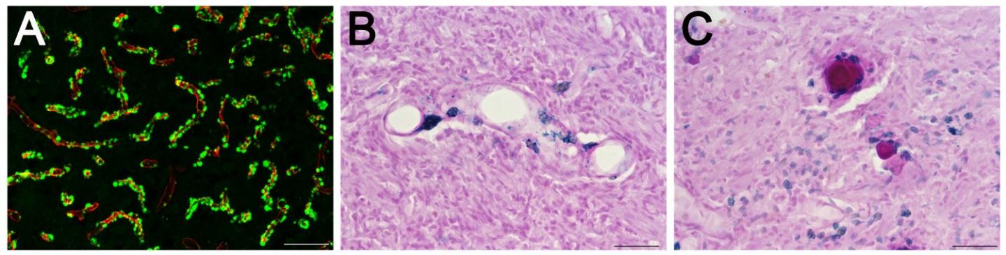 New Transgenic Rat Model May Enable Better Understanding of Amyloid Buildup in Cerebral Blood Vessel