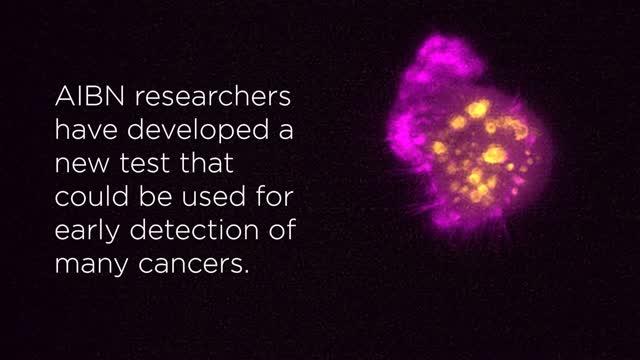 Nano-Signature Discovery Could Revolutionize Cancer Diagnosis