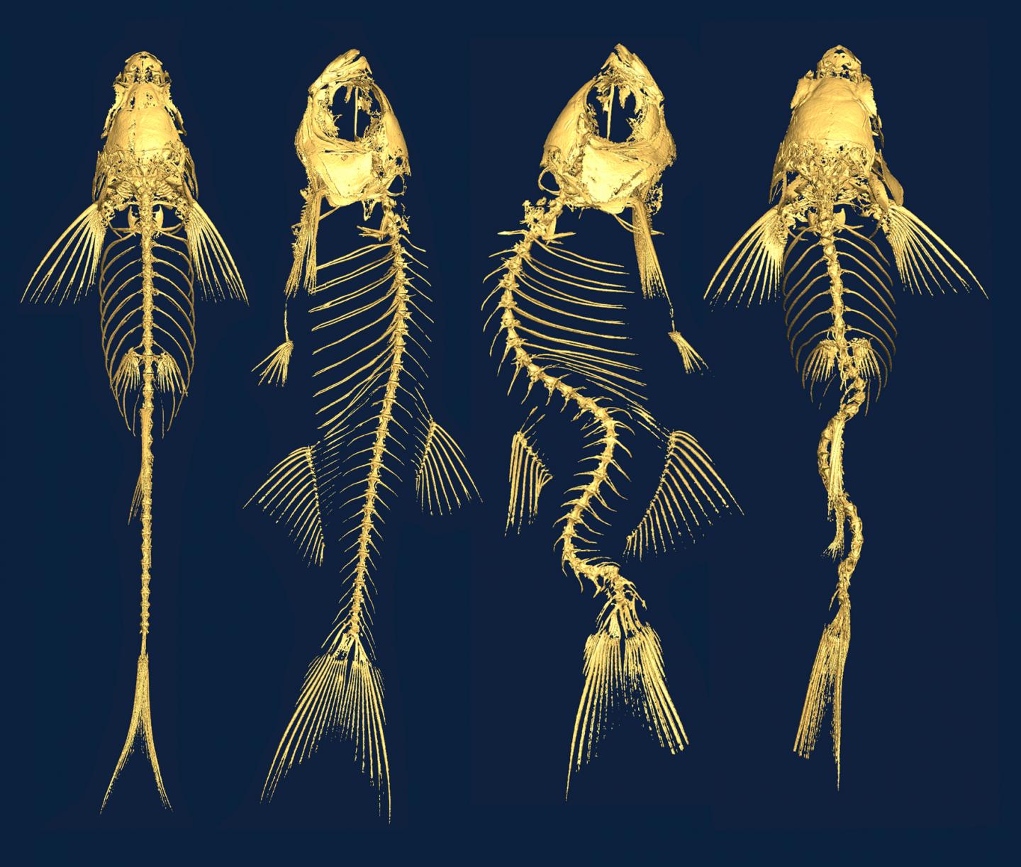 Abnormal Fluid Flow Contributes to Curved Spines (1 of 2)