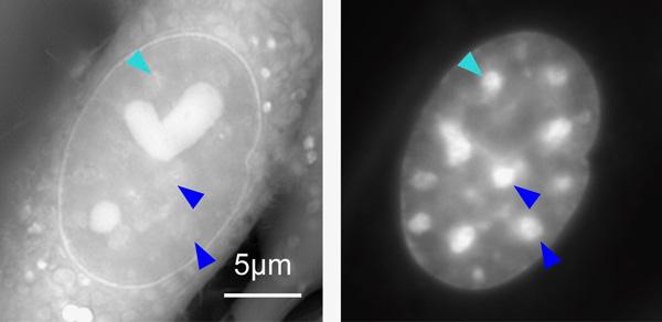 Measurement of Heterochromatin in Live Cells (OI-DIC Microscopy)