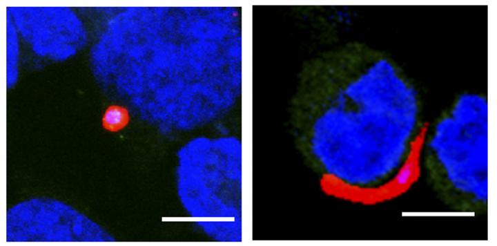 <i>Plasmodium</i> Development in Human Liver Cells