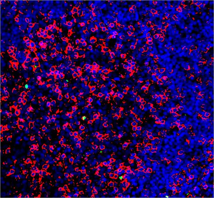 T Follicular Regulatory Cells under the Microscope