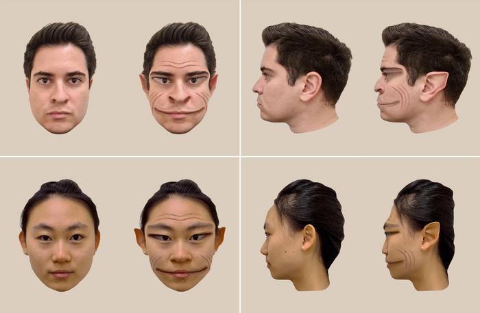 Computer-generated images of face distortions perceived by a PMO patient.