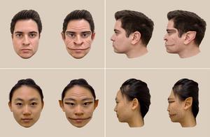 Computer-generated images of face distortions perceived by a PMO patient.