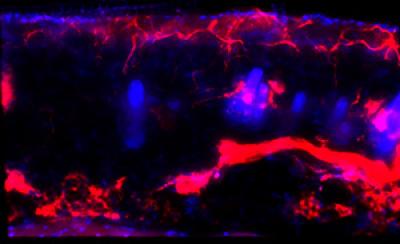 Elevated Itch Signaling