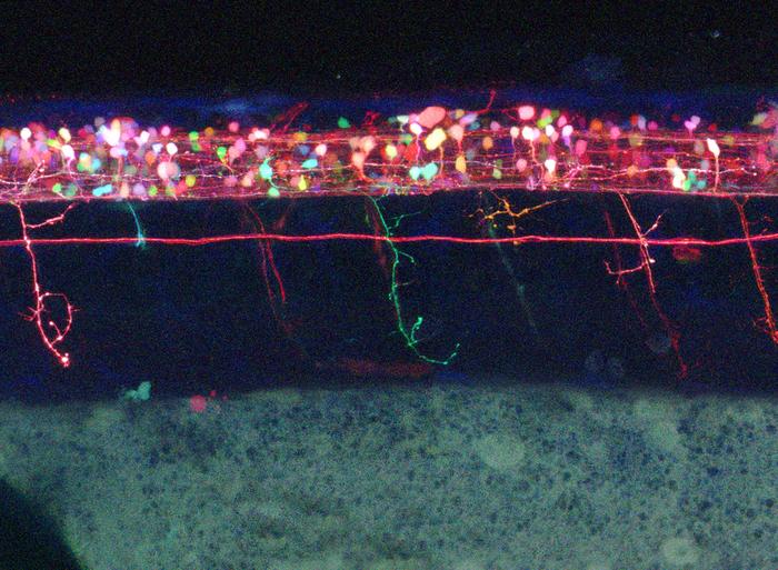Zebrafish spinal cord