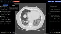 Lung CT with COVID-19