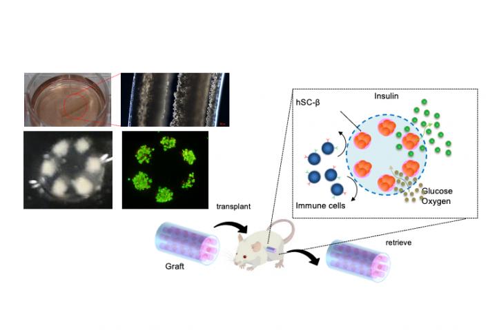 Replacing What Was Lost: a Novel Cell Therapy for Type I Diabetes Mellitus