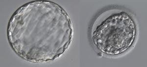 Blastocyst morphology