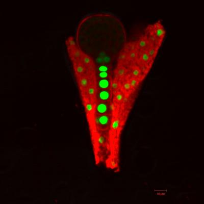 Confocal Laser Scanning Microcope Image