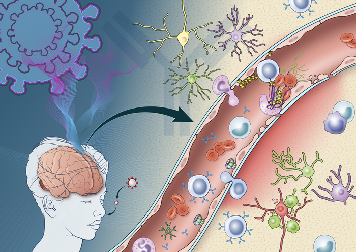 Neurovascular injury from SARS-CoV-2