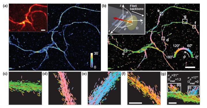 Amyloid Binding