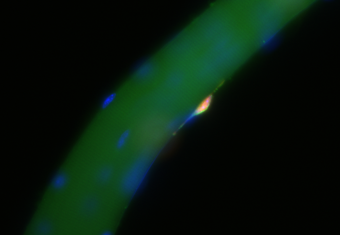 Muscle stem cell on a muscle fiber