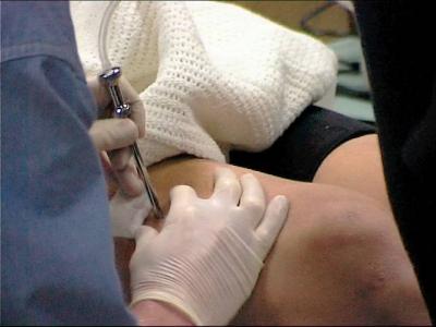 Post-exercise Caffeine Helps Muscles Refuel