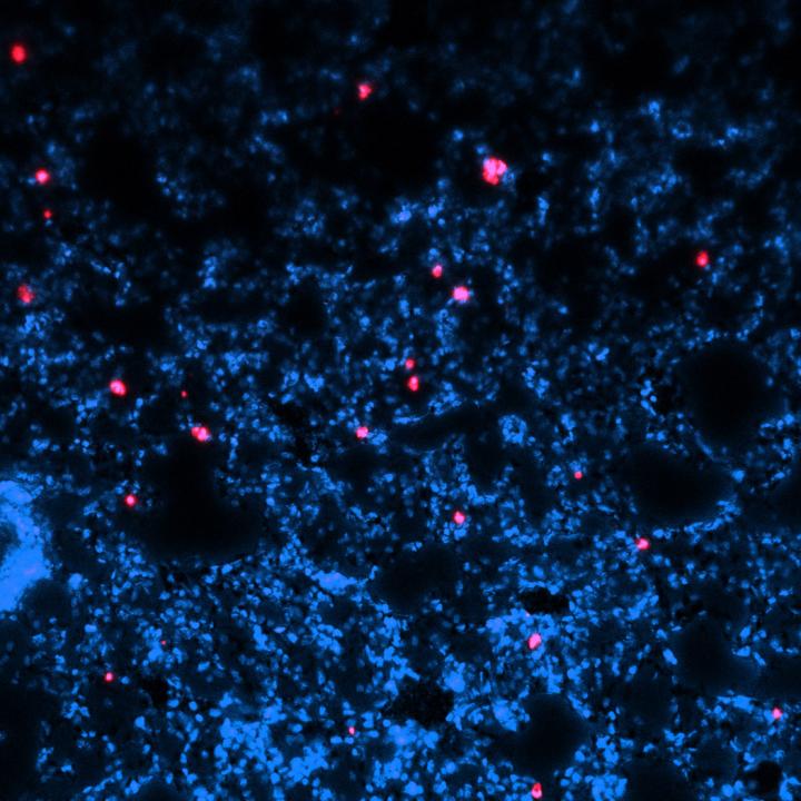 Histological Section of Lung