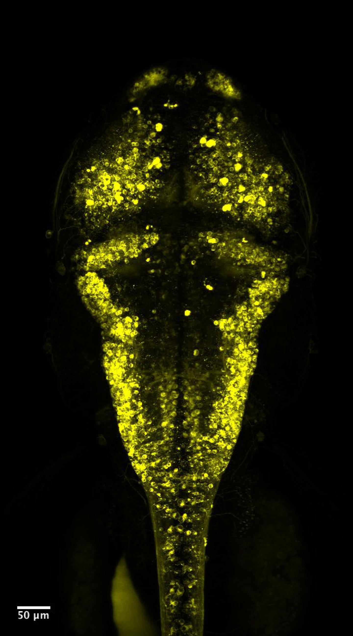 Voltron in a Zebrafish Brain