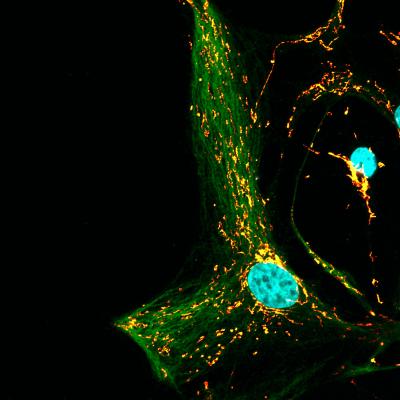 Astrocyte in Gaucher Disease Mouse