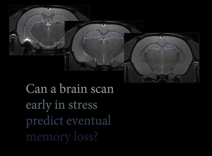 Hippocampal Volume Shrinkage Can Predict Eventual Memory Loss
