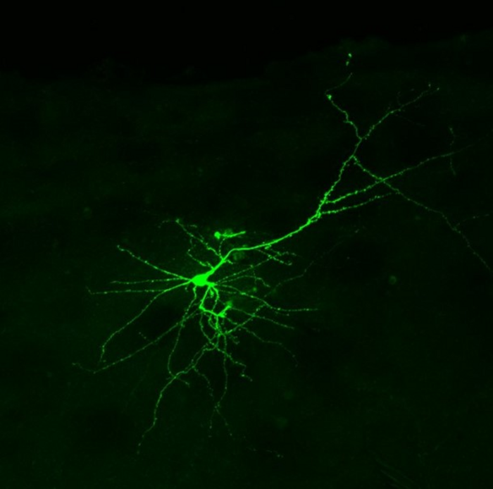 A cultured neuron viewed under a fluorescent microscope