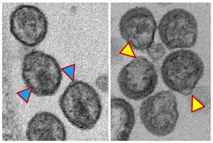 Images of HIV particles