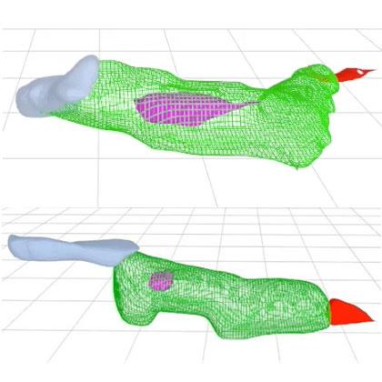 Mutated Gene vs. Healthy Gene