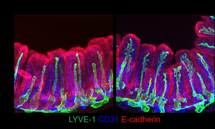 Fig. 2: YAP/TAZ Hyperactivation in Intestinal Stromal Cells Induces Lacteal Sprouting and Branching