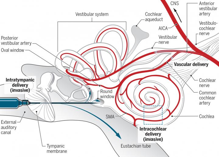 Navigating the Labyrinth of Delivering Therapeutics to the Ear (1 of 1)