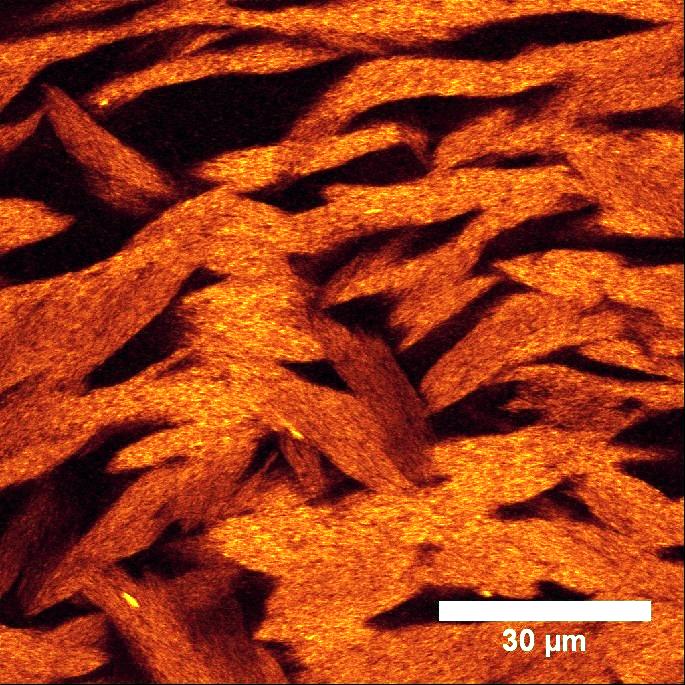 Image of Non-Sticky Gel Taking Using Advanced 3D Light Microscopy Techniques