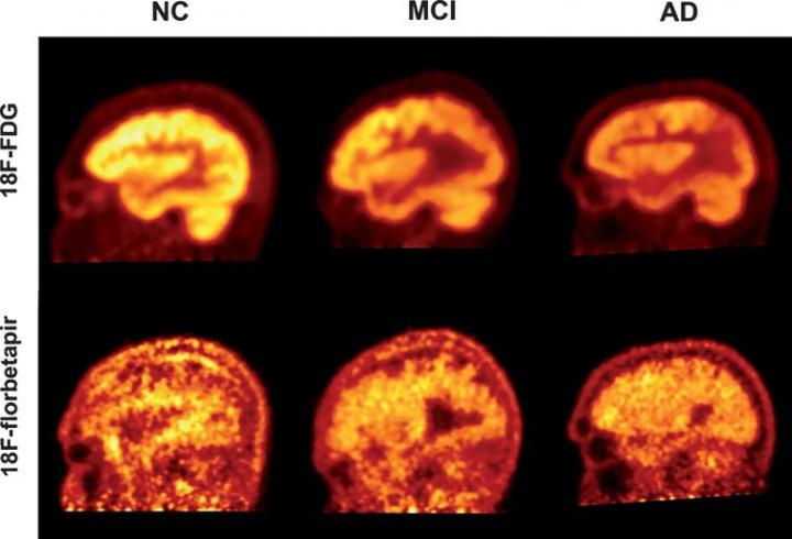 PET Imaging