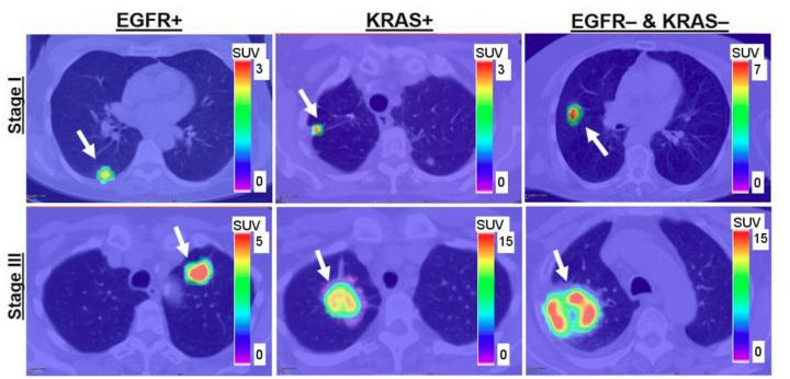 Tumors Harbor Different Somatic Mutations