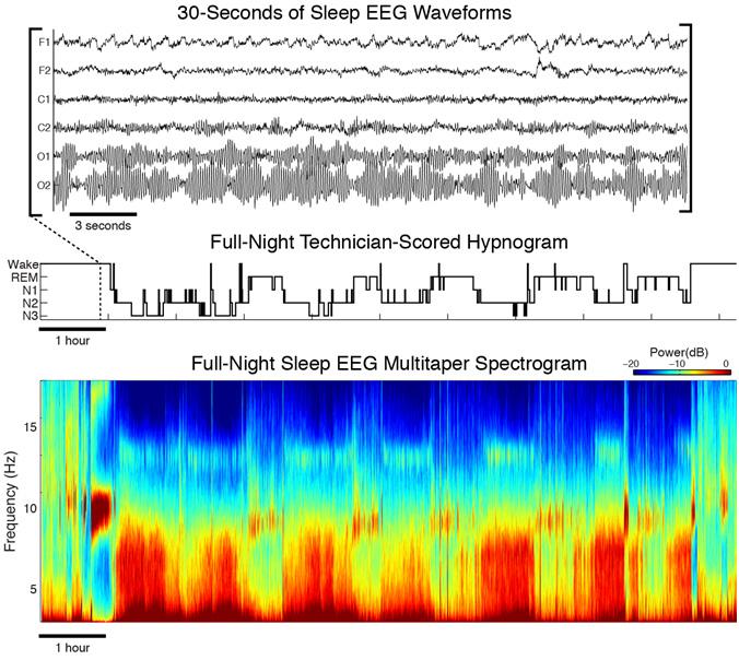 Multitaper Spectrogram Compare with Traditional Hypnogram