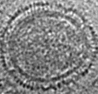 Cryoelectron Tomography Image